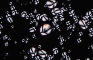 Hạt tinh bột dưới kính hiển vi phân cực phản pha trường tối